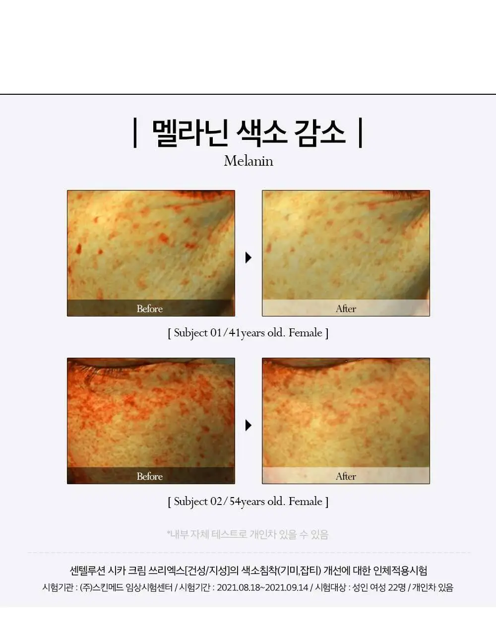 피부미 센텔루션 시카 크림 3X 100ml [지복합성] 상세페이지 9